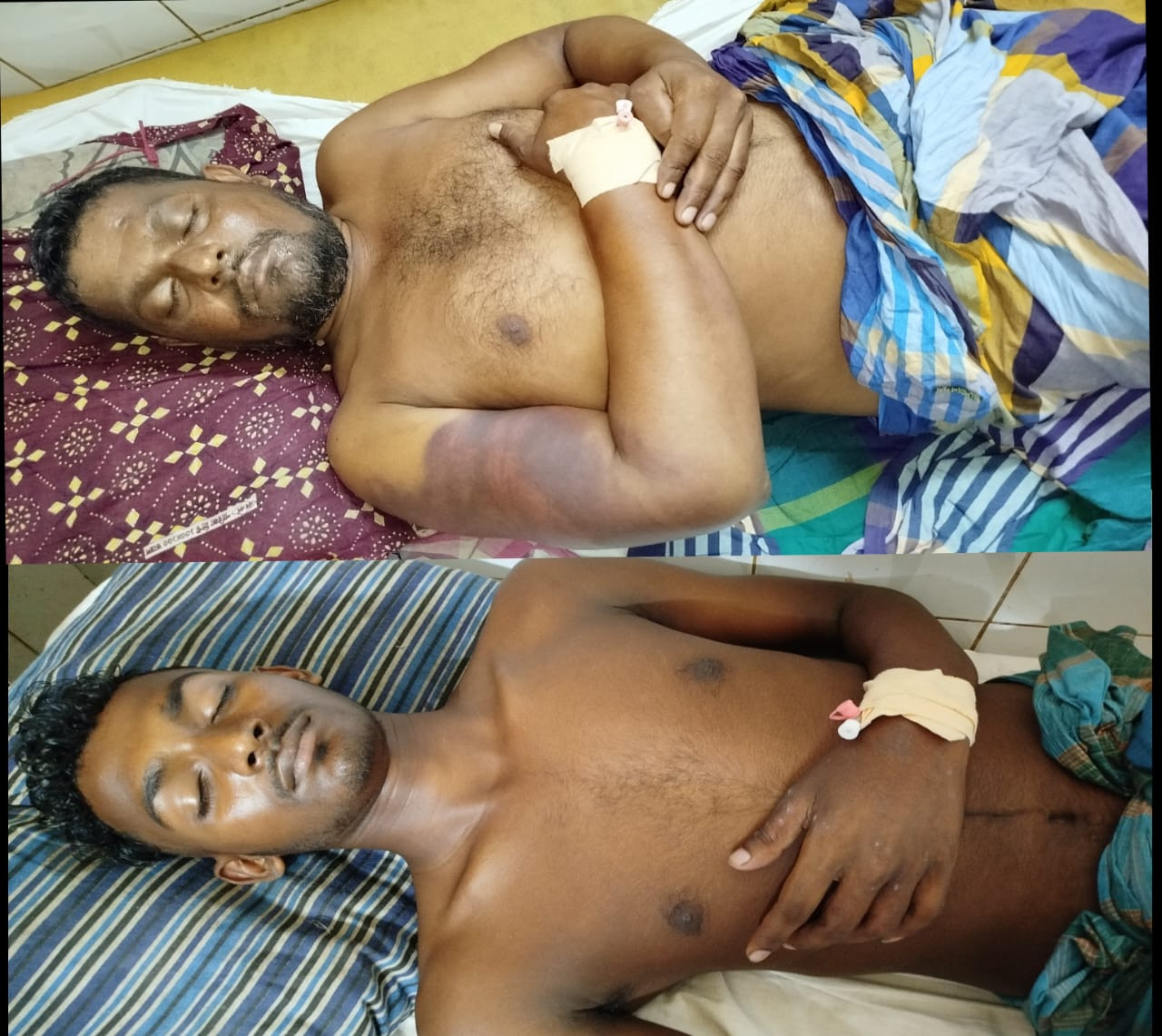 ভোলার দক্ষিণ দীঘলদিতে চাঁদা না পেয়ে কৃষকের উপর অমানুষিক নির্যাতন চালিয়েছে সন্ত্রাসীরা