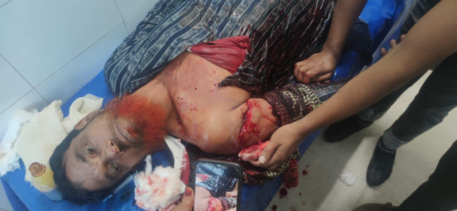 ভোলায় ব্যবসায়ীকে নির্মম ভাবে কুপিয়ে ১০লাখ টাকা ছিনিয়ে নেয়ার অভিযোগ